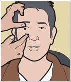 Contact Lens Assessment